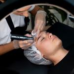 Skalp ink micropigmentation - photo 4