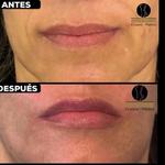 Doctor Victor Reyes Cirujano Plástico  - photo 2