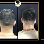 Doctor Victor Reyes Cirujano Plástico  - photo 3