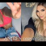 Doctor Victor Reyes Cirujano Plástico  - photo 4