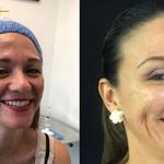 Doctor Victor Reyes Cirujano Plástico  - photo 5