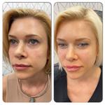 Injections by Megan - photo 4