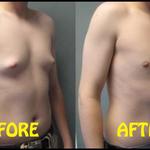 Tummy tuck cost in Lahore - photo 1