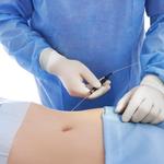 Tummy tuck cost in Lahore - photo 4