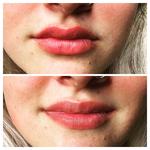 Skinsation Aesthetics - photo 2