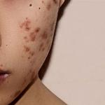 Dana Point Acne Lab & Skincare Studio - photo 8