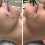 Dana Point Acne Lab & Skincare Studio - photo 10