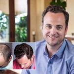 Bosley - Hair Restoration & Transplant - photo 4