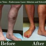 Center for Advanced Vein Care - photo 2