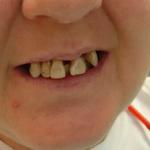 Dover Family Dentistry - Dentist in Mountain Home AR - photo 3