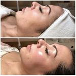 Revo Weight Loss St Petersburg FL - photo 1