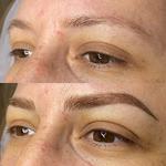 Revo Weight Loss St Petersburg FL - photo 2