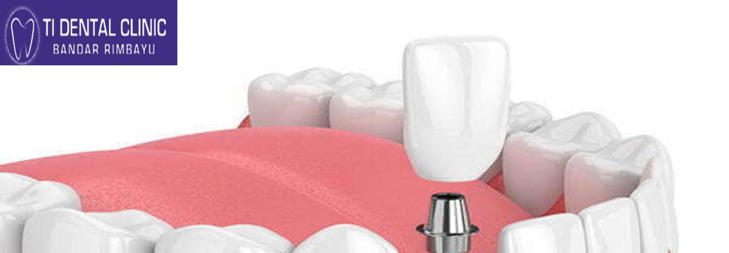 Ti Dental Clinic , Bandar Rimbayu cover photo
