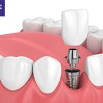 Ti Dental Clinic , Bandar Rimbayu - photo 1