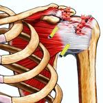 Regen Doctors | Pain Specialists | Gene V. Levinstein M.D. | Bethlehem, PA - photo 5