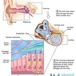 Industrial Deafness Australia - photo 6