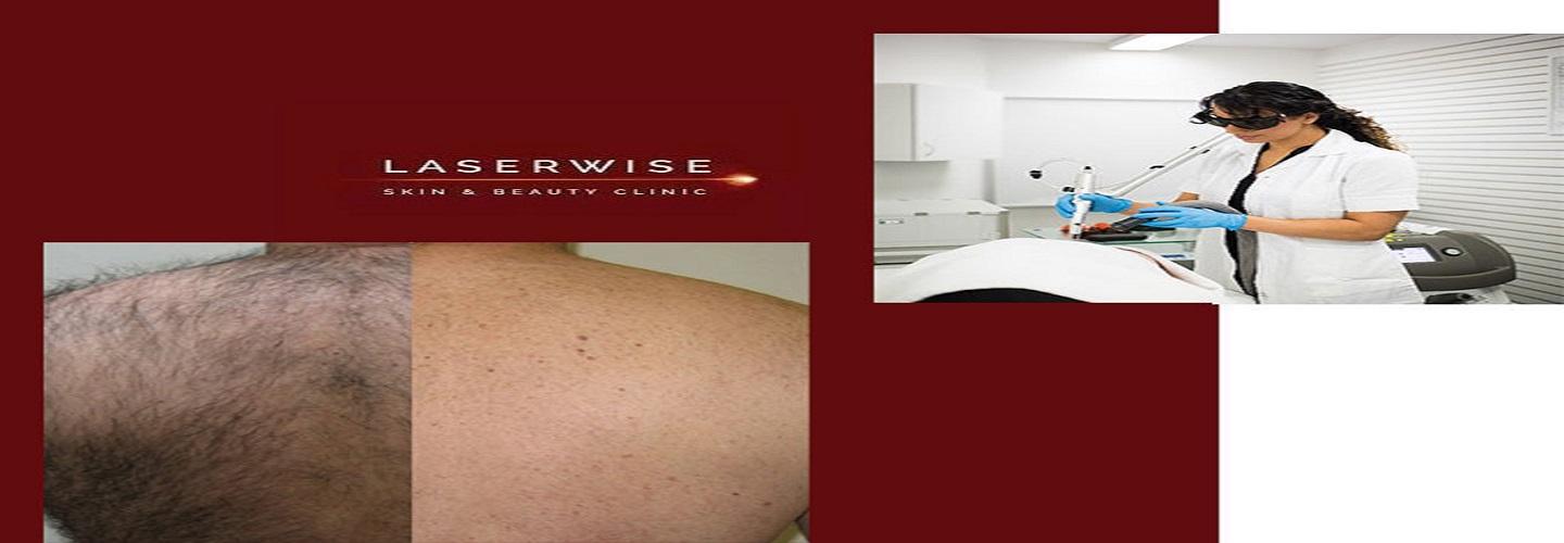 LaserWise Skin & Beauty Clinic cover photo