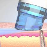Esthetics by Dawn - Roseville HydraFacial & Jet Plasma - photo 1