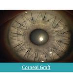Dr Chameen Samarawickrama - Eye Surgeon Blacktown - photo 2