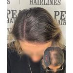 Peaky Hairlines - photo 3