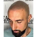 Peaky Hairlines - photo 4