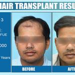Dermalife - Best Dermatology | Hair Transplant Clinic in Delhi - photo 1