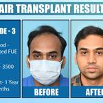 Dermalife - Best Dermatology | Hair Transplant Clinic in Delhi - photo 2