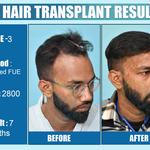 Dermalife - Best Dermatology | Hair Transplant Clinic in Delhi - photo 3