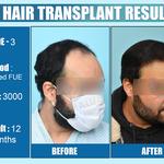 Dermalife - Best Dermatology | Hair Transplant Clinic in Delhi - photo 8