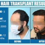 Dermalife - Best Dermatology | Hair Transplant Clinic in Delhi - photo 9