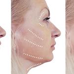 The Shoreline Center For Laser And Cosmetic Surgery - photo 3