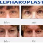 The Shoreline Center For Laser And Cosmetic Surgery - photo 4