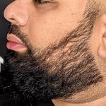 Zang SMP - Scalp Micropigmentation Orange County - photo 6