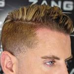 Zang SMP - Scalp Micropigmentation Orange County - photo 7