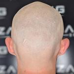 Zang SMP - Scalp Micropigmentation Orange County - photo 8