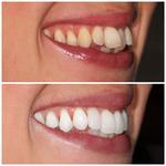 The Smile Gallery - photo 6