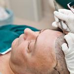 Reflect Hair Restoration - photo 1