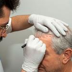 Reflect Hair Restoration - photo 2