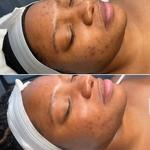 Bloom Aesthetics Studio - photo 4