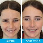 Solas Orthodontics - photo 3
