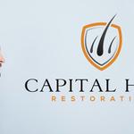 Capital Hair Restoration - Hair Transplant - photo 4