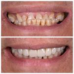 Cosmetic Dentist Brisbane | My Cosmetic Dentist  - photo 1