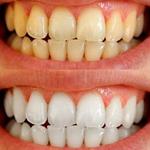 Brows and lashes Magic Melbourne - photo 3