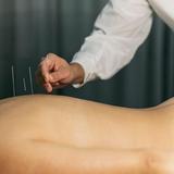 Cambridge Acupuncture Association - Acupuncture in Cambridge