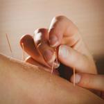 Cambridge Acupuncture Association - photo 2