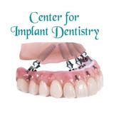 Center For Implant Dentistry