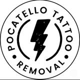 Pocatello Tattoo Removal - Tattoo Removal in Pocatello