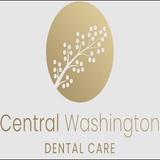 Central Washington Dental Care - Dental Implants in Ellensburg