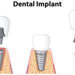 Bosque Farms Family Dentistry - photo 1