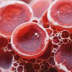 vasculex servioce - photo 6